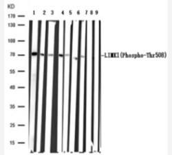 LIM Kinase 1, p Thr508 Antibody, Novus Biologicals 0.05 mL | Buy Online | Novus Biologicals | Fisher Scientific